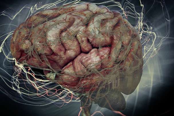 tDCS Therapie bei Angststörung