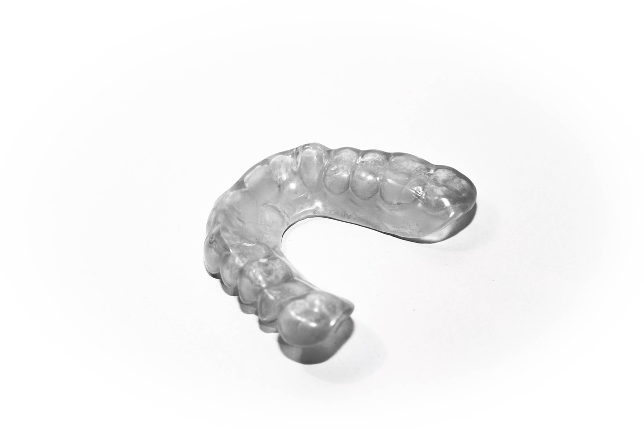 tooth splint 2633035 1280